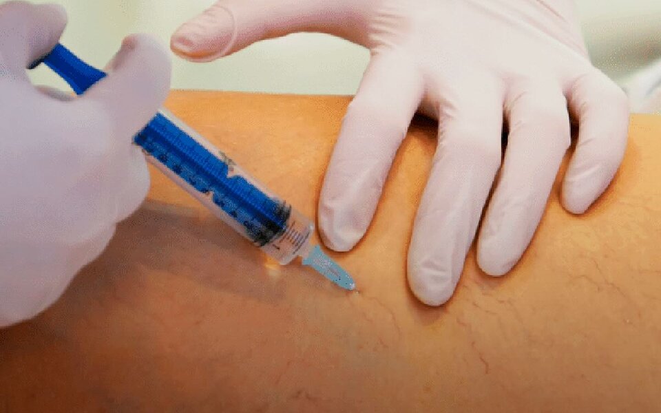 Laser e espuma: o que mudou no tratamento de varizes