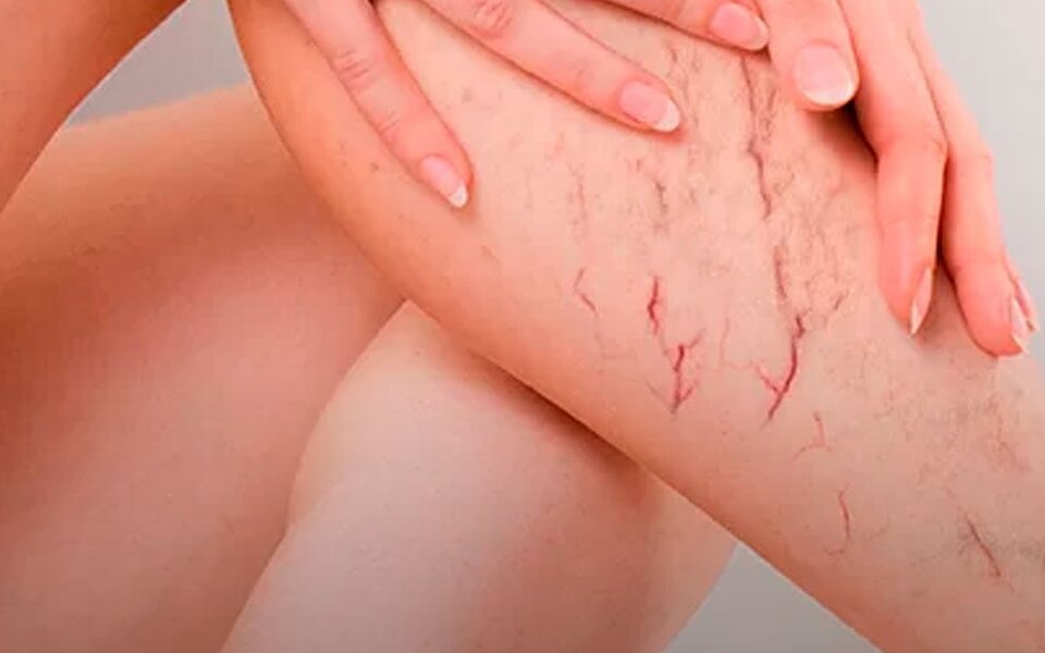 5 sinais de que sua circulação pede ajuda